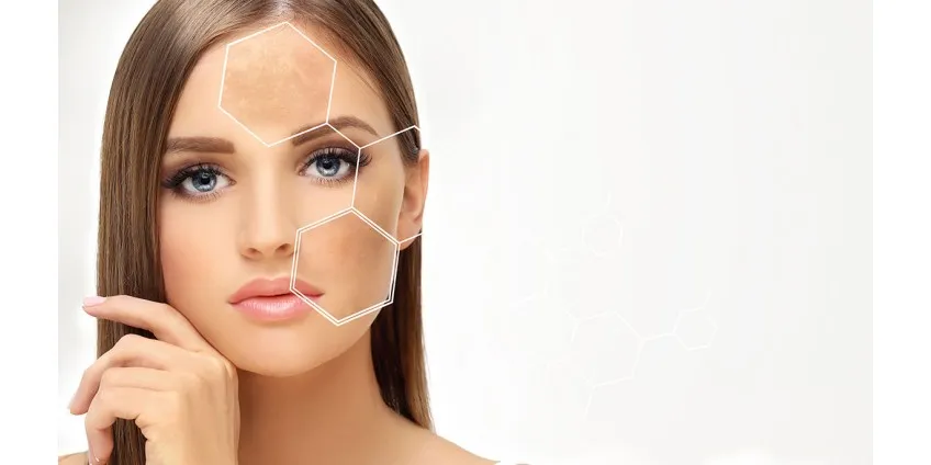 Mesoterapia: con aghi o senza. Confrontiamo efficacia e comfort