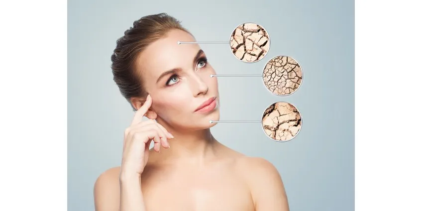 Secchezza cutanea in autunno e in inverno: soluzioni efficaci per protezione e ripristino