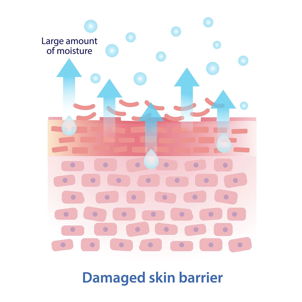 che cos’è una barriera cutanea compromessa e perché è un problema