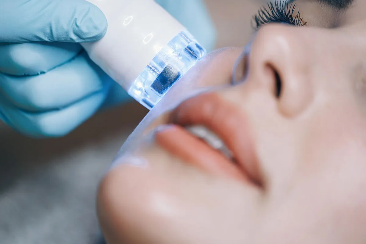 Che cos'è l'idrodermoabrasione