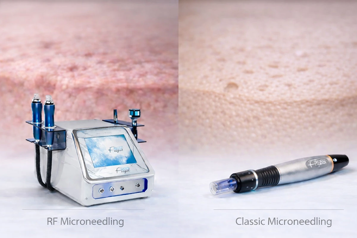 Microneedling RF o microneedling classico