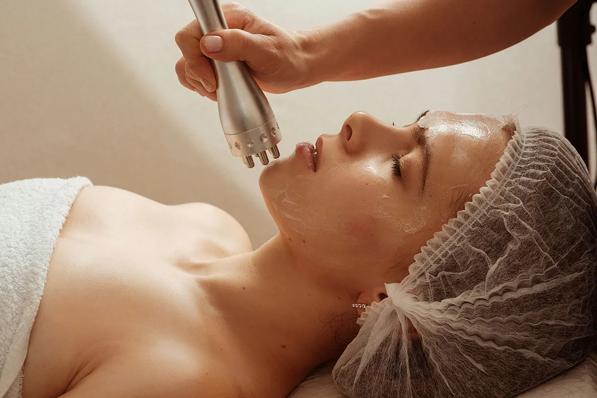 Radiofrequenza lifting