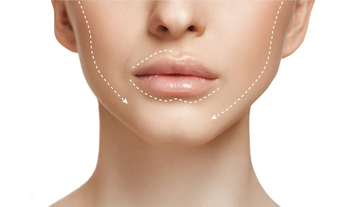 confronto tra radiofrequenze viso e HIFU