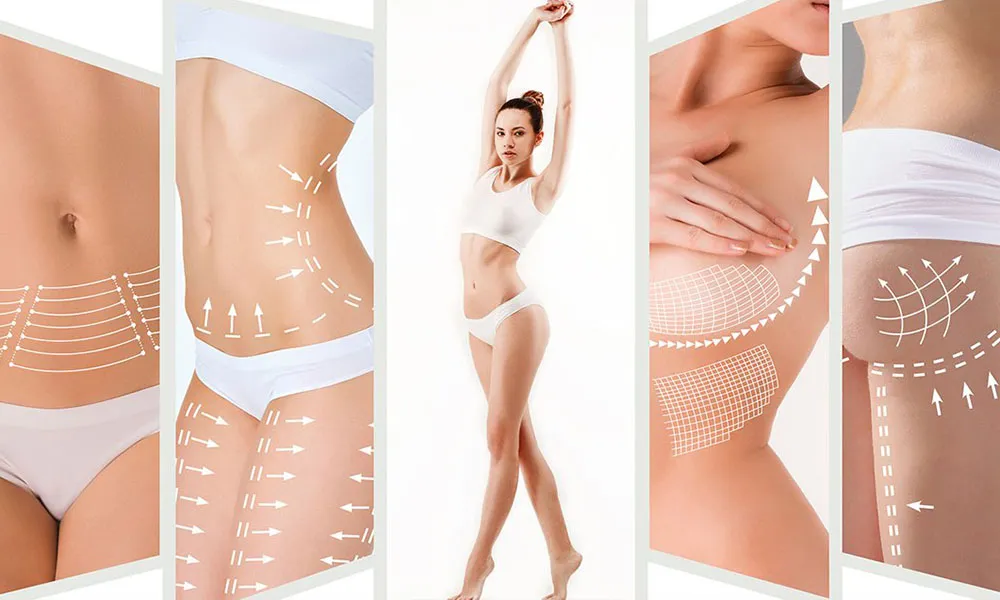 cavitazione e massaggio a vuoto: un doppio colpo alla cellulite