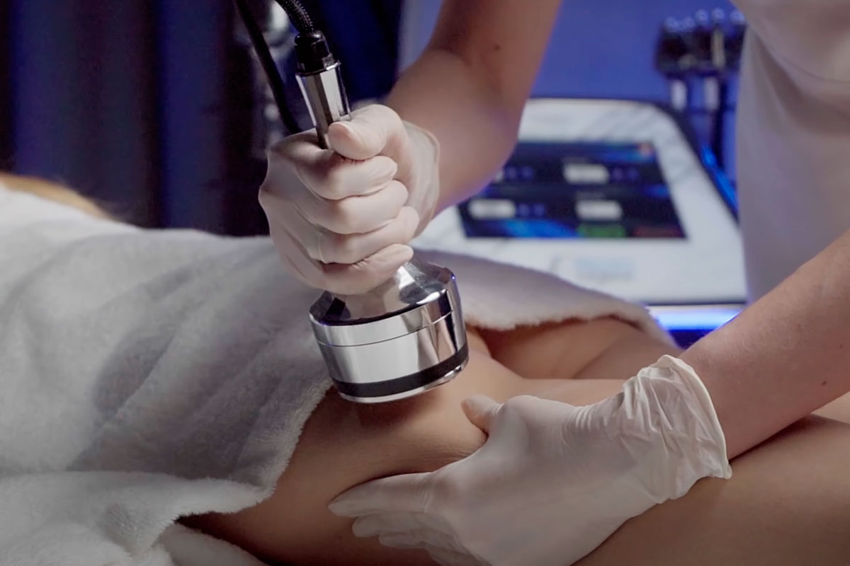 Risultati e durata dell'effetto: cosa aspettarsi