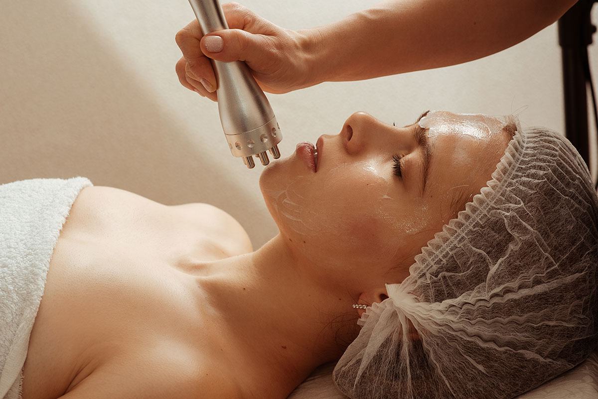 Radiofrequenza lifting